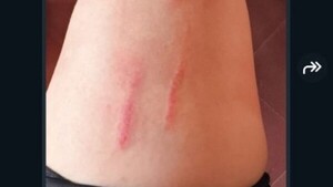 Ciclista acosada: “Un tipo repartidor me tocó, yo me asusté y me caí”, relató