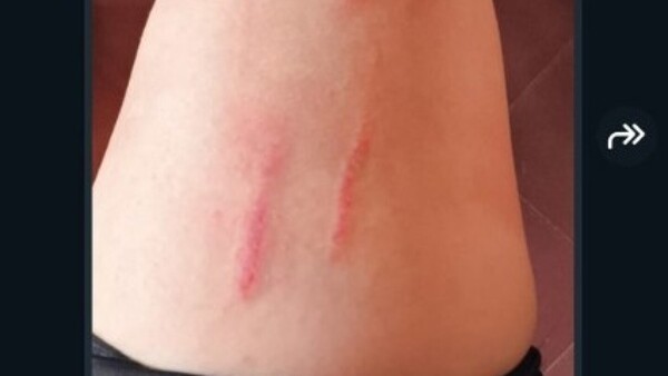 Ciclista acosada: “Un tipo repartidor me tocó, yo me asusté y me caí”, relató