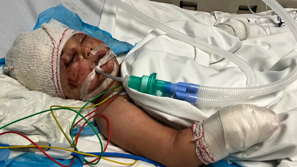 Un niño libanés se recupera luego de 14 horas sepultado tras un ataque israelí