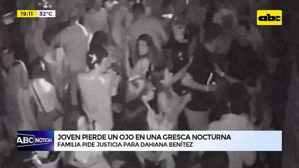 Video: joven pierde un ojo durante una gresca en discoteca asuncena - ABC Noticias - ABC Color