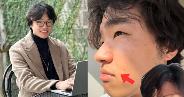 La Nación / “La vida es difícil para un asiático”: Lo que sufre el influencer Kotaro