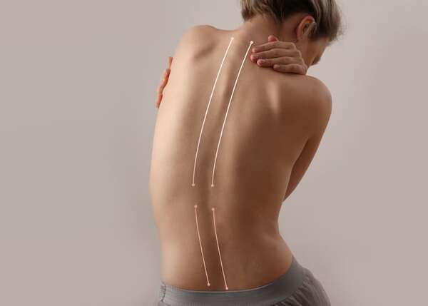 La columna vertebral duele, posturas y ejercicios recomendados - Estilo de vida - ABC Color