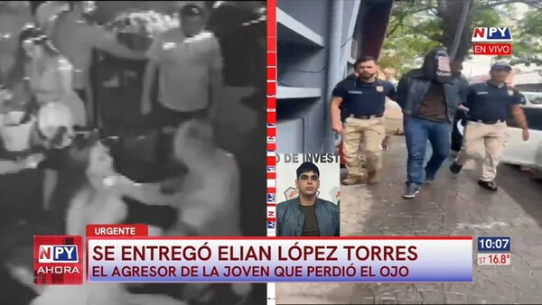 Se entregó el presunto agresor de la joven que perdió un ojo