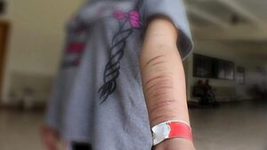 Alarmantes casos de autolesiones con objetos cortantes en escuelas