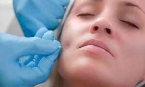 Clínica privada es clausurada tras la muerte de una mujer que se hizo lipopapada – Prensa 5