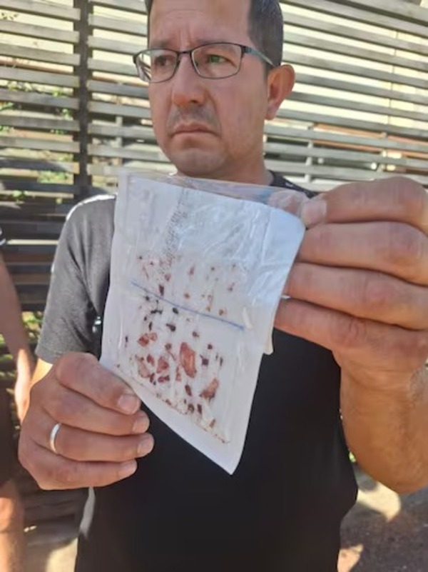 Preparan querella adhesiva para caso de joven que perdió el ojo por agresión - 1000 Noticias