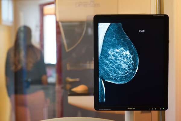 Habilitan primer servicio de mamografía en Boquerón - Noticias del Chaco - ABC Color