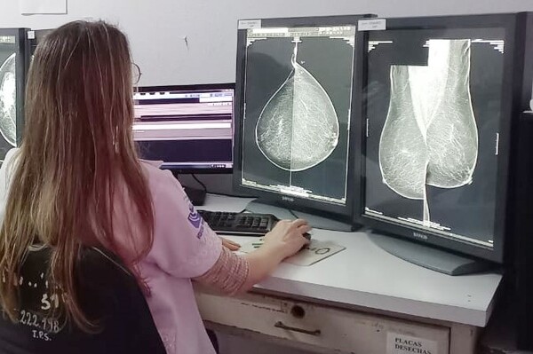 Instalación de nuevos mamógrafos genera récord de estudios para diagnóstico temprano de cáncer - .::Agencia IP::.