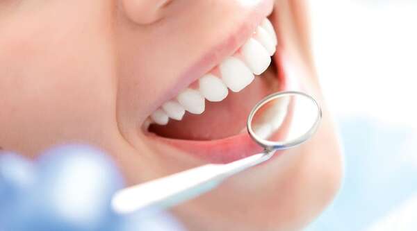 Dientes de “porcelana” para Diputados costará más de G. 5.000 millones a los paraguayos - Política - ABC Color