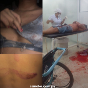 UN HOMBRE FUE MACHETEADO TRAS DEFENDER A SU HIJA EN UN INTENTO DE ABUSO SEXUAL