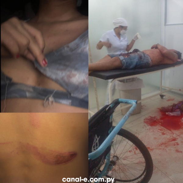 UN HOMBRE FUE MACHETEADO TRAS DEFENDER A SU HIJA EN UN INTENTO DE ABUSO SEXUAL