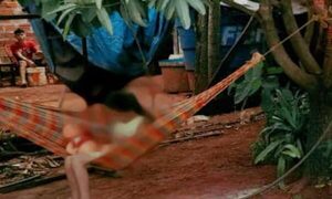 Rescatan a niña pese a oposición de sus abuelos, infectada de piques en manos y pies - ADN Digital