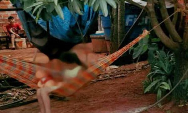 Rescatan a niña pese a oposición de sus abuelos, infectada de piques en manos y pies - ADN Digital