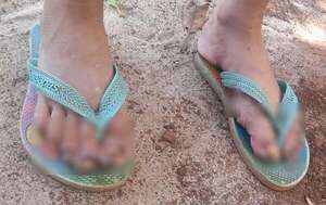 Rescatan a niña de siete años con los pies y manos infestados de piques - ABC en el Este - ABC Color