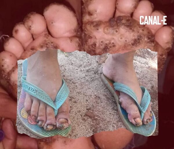 NIÑA FUE RESCATADA DE LA CASA DE SUS ABUELOS: TENÍA MÁS DE 100 PIQUES EN TODO EL CUERPO
