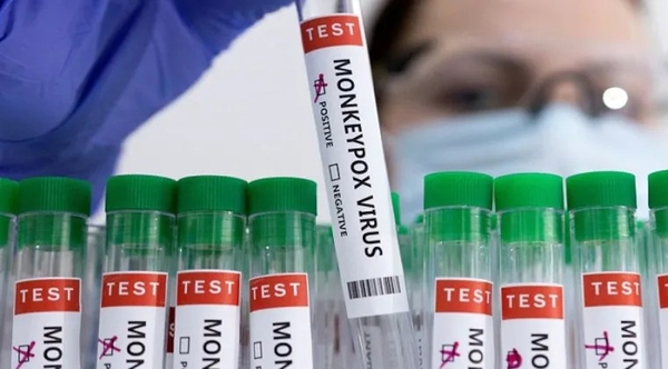 OMS aprueba la segunda vacuna contra la viruela símica