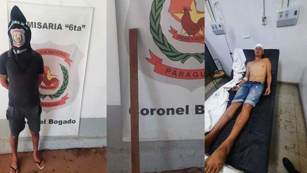 Con barra de hierro, agredió en la cabeza a un hombre en Coronel Bogado