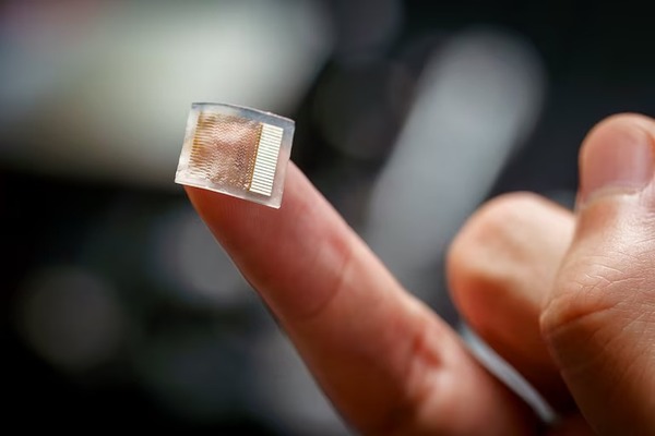 ¿Cómo funciona el parche cutáneo que podría controlar la presión arterial?