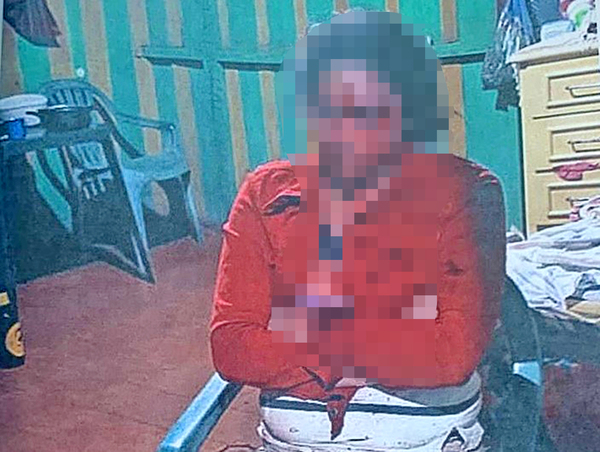 Ínfima condena a sujeto por brutal golpiza a su pareja y fiscal anuncia apelación - La Clave