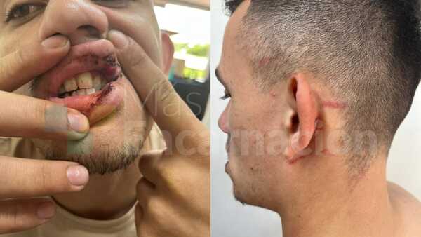 Empleado denuncia brutal agresión supuestamente por parte de su jefe en Encarnación
