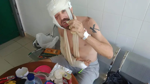 Cabras salvan a hombre tras accidente mortal