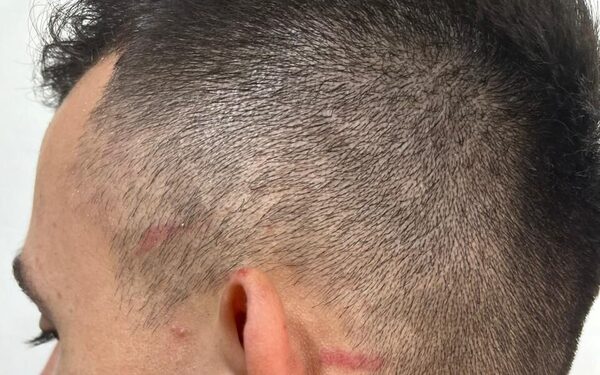 Joven fue atacado a puñetazos y a balazos por su jefe en una bodega