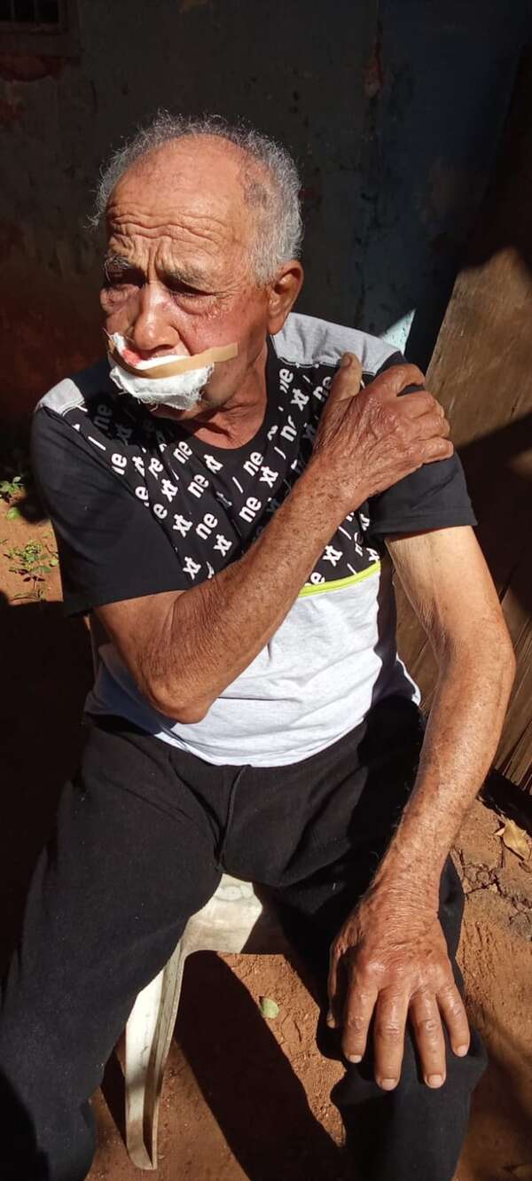 Quedó sin movilidad en el brazo tras brutal agresión de un chofer, tiene 77 años - Policiales - ABC Color