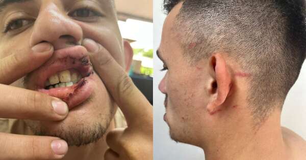 Diario HOY | Su jefe llegó borracho a la bodega, lo golpeó y baleó: joven denuncia agresión