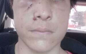 Video: mujer fue golpeada brutalmente tras reclamar acoso callejero en el centro de Asunción - Policiales - ABC Color