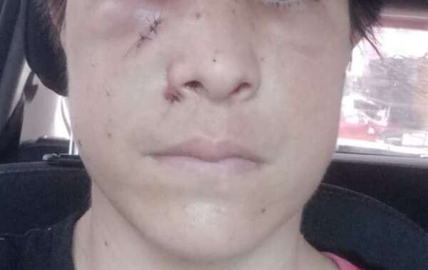 Video: mujer fue golpeada brutalmente tras reclamar acoso callejero en el centro de Asunción - Policiales - ABC Color