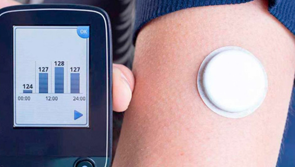 Bajo control: Estas son las nuevas tecnologías en el tratamiento de la diabetes tipo 1