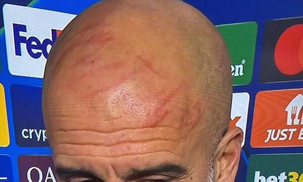 (VIDEO) ¡Pep Guardiola se arañó la cabeza y la cara porque ndoikoi su equipo!