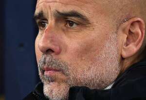 Pep Guardiola: los cortes en la cara y qué dijo en conferencia - Fútbol Internacional - ABC Color