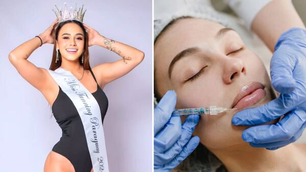 Modelo cañeó a tuneadas: “Tienen labios de chorizo”