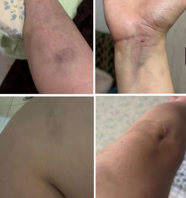 Médico habría agredido brutalmente a su novia en Ciudad del Este - ABC en el Este - ABC Color
