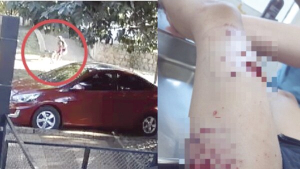 Pitbull mordió a niña de 6 años y dueños del perro se mudan de casa