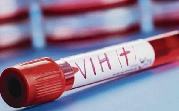 Día Mundial del VIH: en América Latina las infecciones aumentaron 9% desde 2010