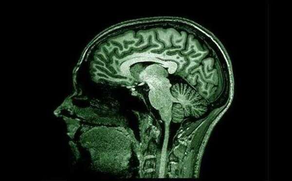 Investigación revela vínculos entre la obesidad y el alzheimer - Ciencia - ABC Color