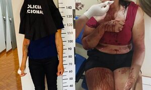 Joven detenida en Santa Rita por atacar a su madrastra con una botella rota