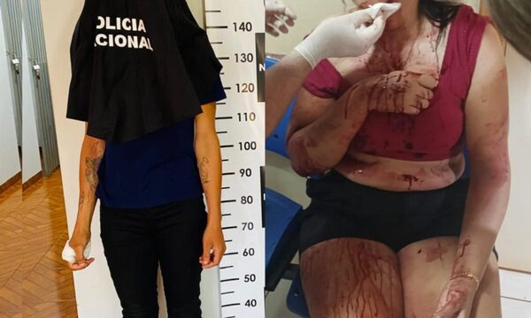 Joven detenida en Santa Rita por atacar a su madrastra con una botella rota