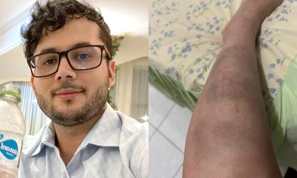 Ordenan detención de médico que golpeó brutalmente a su pareja en Ciudad del Este - La Clave