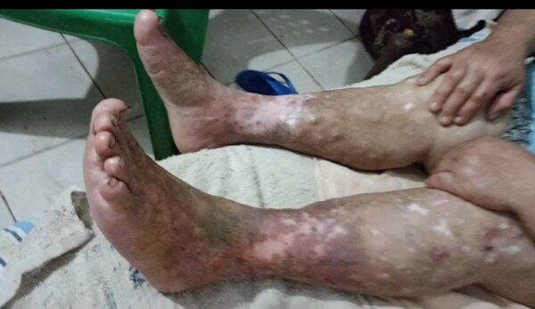 Pareja de ancianos necesita urgente atención médica y ayuda para sobrellevar el calor extremo » San Lorenzo PY