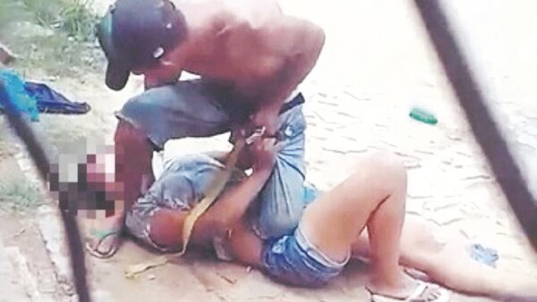 Tipo que fue apretado “ahí abajo” ¿quedará con lesiones?