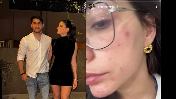 Estrés por la boda tiene chalái a prometida de Tito Torres: "Me salieron granitos en la cara"
