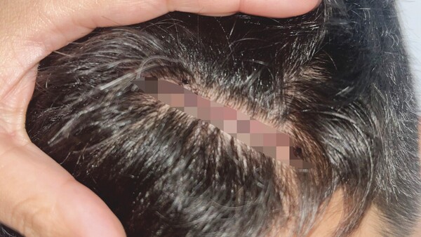 Médico apuñaló al novio de una enfermera tras farra de fin de año