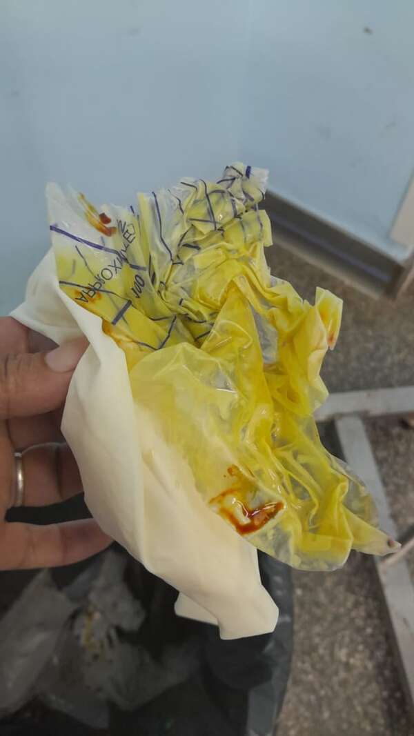 En IPS dejaron bolsa colectora de orina en interior de una abuelita que se operó de hernia inguinal - Nacionales - ABC Color