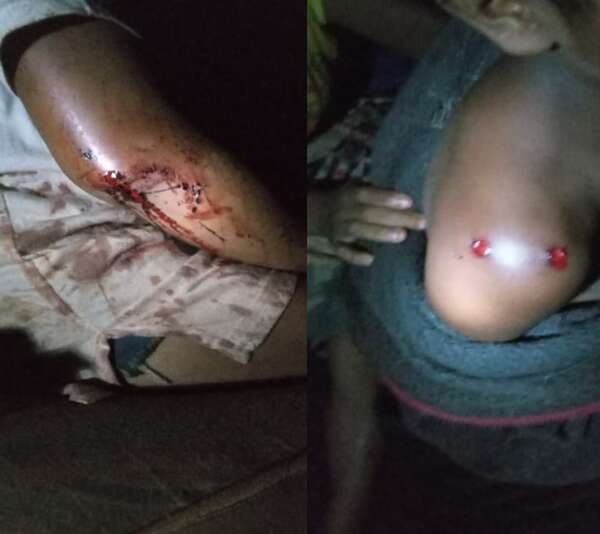 Canindeyú: niños resultaron heridos de refilón de bala y Policía apunta a conflicto entre indígenas - Policiales - ABC Color