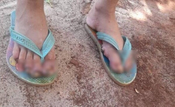 ¡De terror!: Niña con piques también fue víctima de abuso