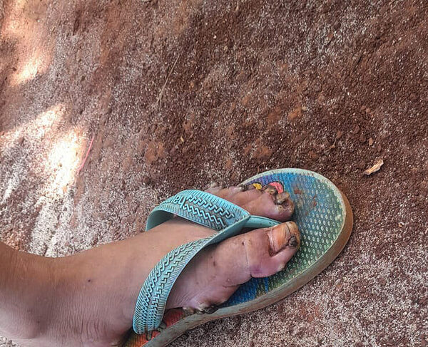 Niña rescatada con piques también habría sido abusado sexualmente