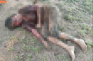 Perros pitbul atacan a una mujer tras ingresar a una granja en Caaguazú